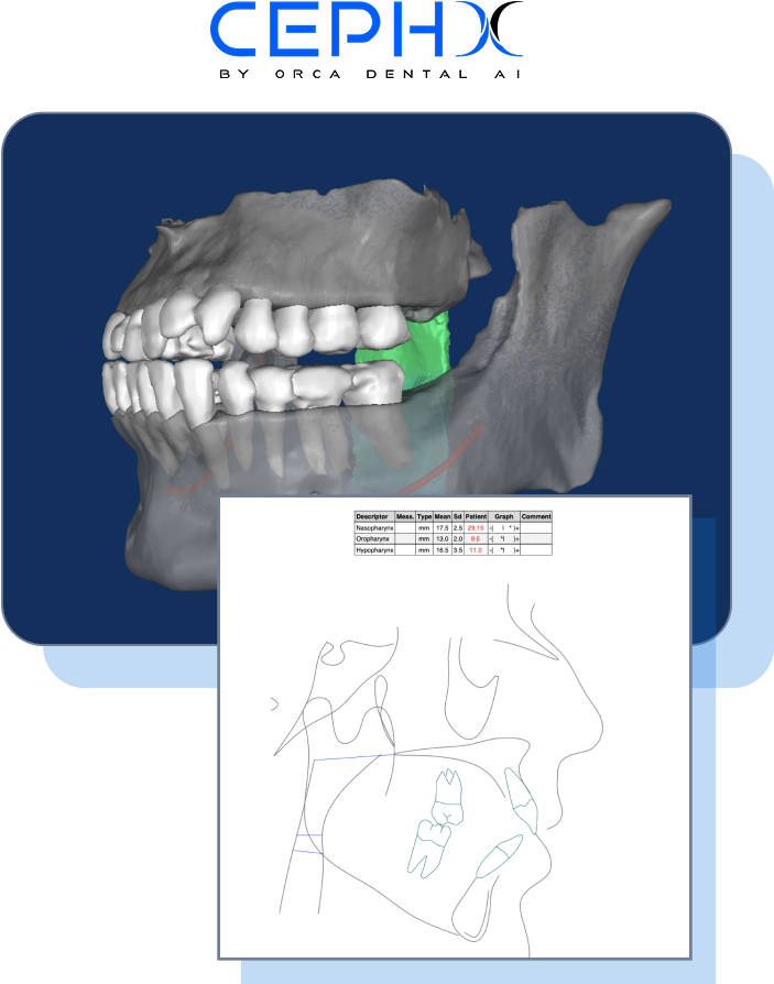 Image depicting a completed report and STL Viewer with the CephX company logo.